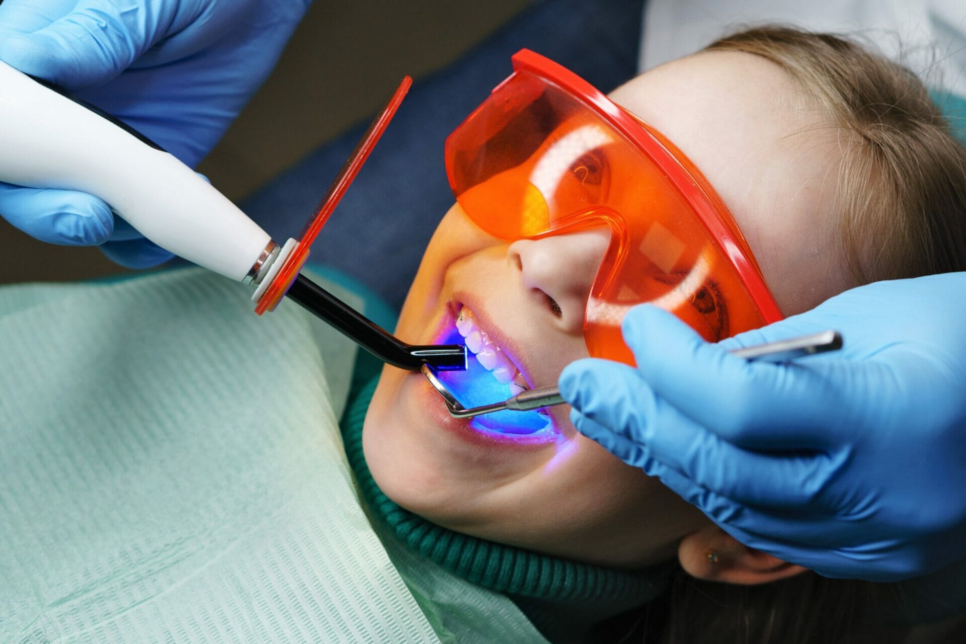 Do Cavities Hurt? By Dr. Kyle Hornby, Kitchener Dentist
