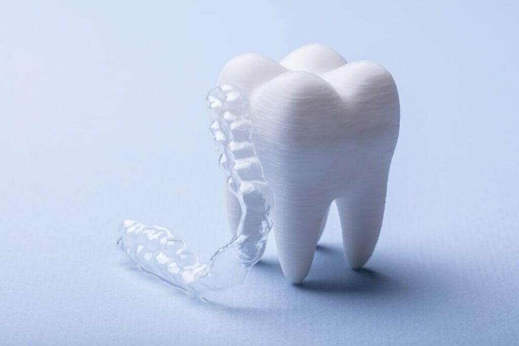 Invisalign 10 Things You Need to Know ? ENAMEL REPUBLIC